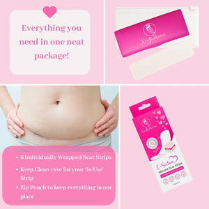 Transparent C-Section Silicone Scar Strips - Pack of 6 - Ninja Mama