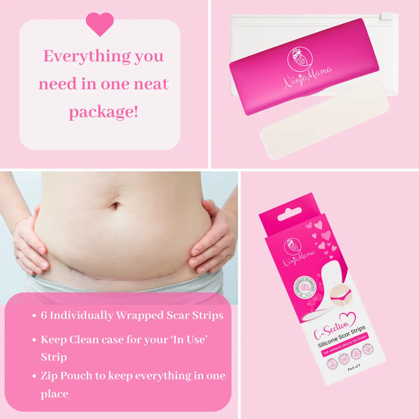 Transparent C-Section Silicone Scar Strips - Pack of 6 - Ninja Mama