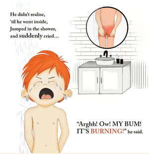 The Adventures of Willy and his Sunburnt Bum!  Adventures with Tara