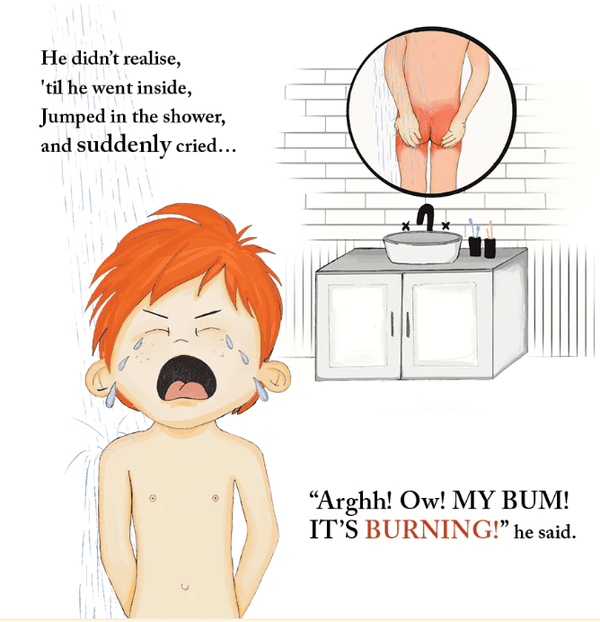 The Adventures of Willy and his Sunburnt Bum!  Adventures with Tara